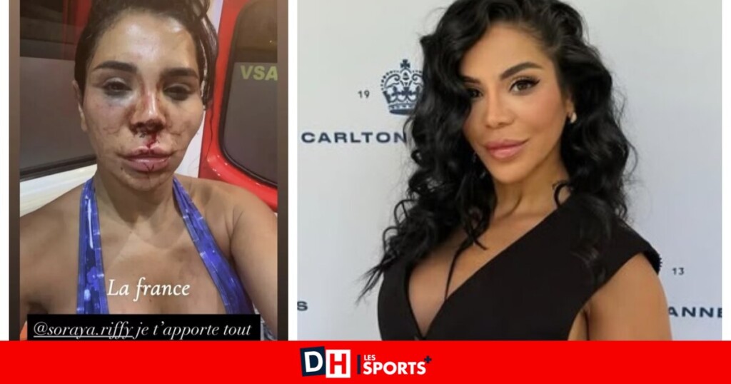 Soraya Riffy, suivie par un million d’abonnés, s’est évanouie durant un violent cambriolage à domicile Soraya Riffy, suivie par un million d’abonnés, s’est évanouie durant un violent cambriolage à domicile