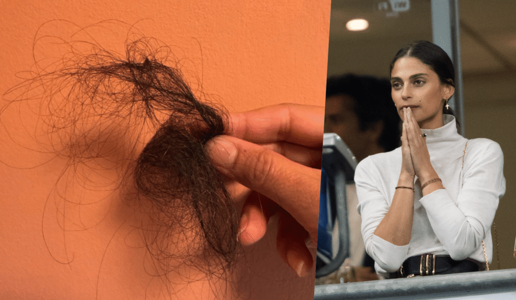 Tatiana Silva, récemment maman, révèle sa souffrance face à la perte de cheveux Tatiana Silva, récemment maman, révèle sa souffrance face à la perte de cheveux